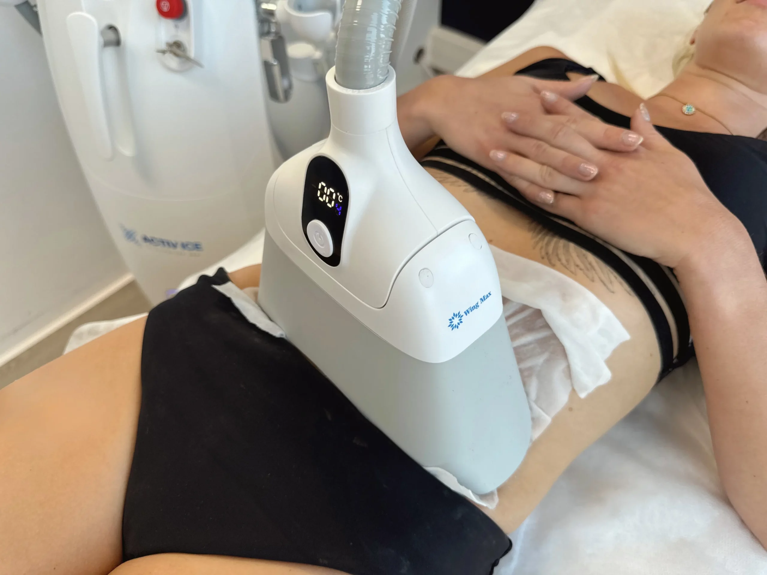 institut de beauté castres soin cryolipolyse
