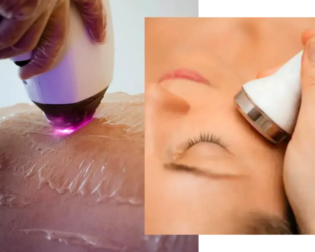 institut de beauté castres tech esthetique
